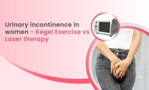 Urinary incontinence in women - kegel exercises vs. Laser therapy